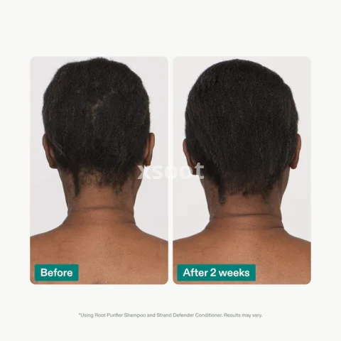 Shampoo & Conditioner Duo for Thinning Hair